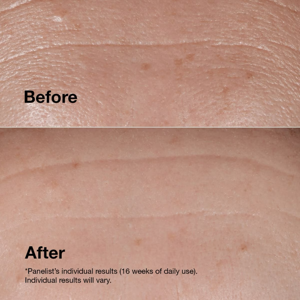 Clinique Smart Clinical Repair Wrinkle Correcting Serum 50ml