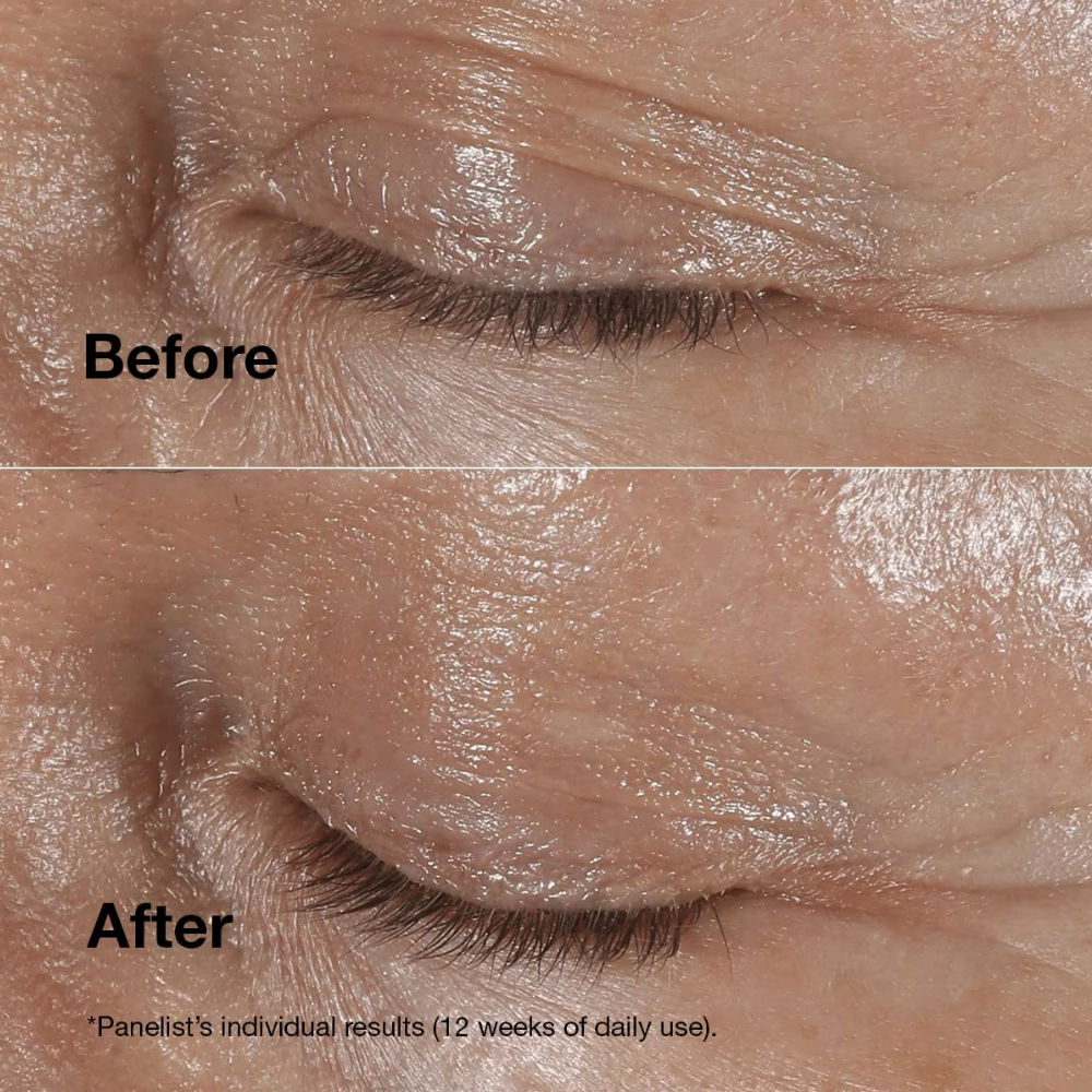 Clinique Smart Clinical Repair Wrinkle Correcting Eye Cream 15ml