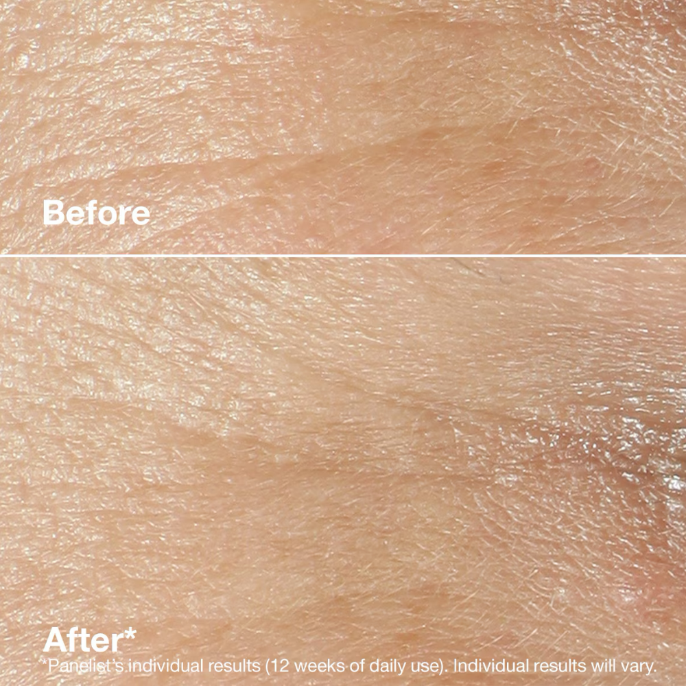 Clinique Smart Clinical Repair Wrinkle Correcting Rich Cream 50ml