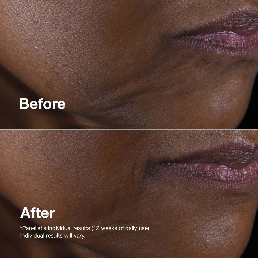 Clinique Smart Clinical Repair Lifting Face & Neck Cream 50ml