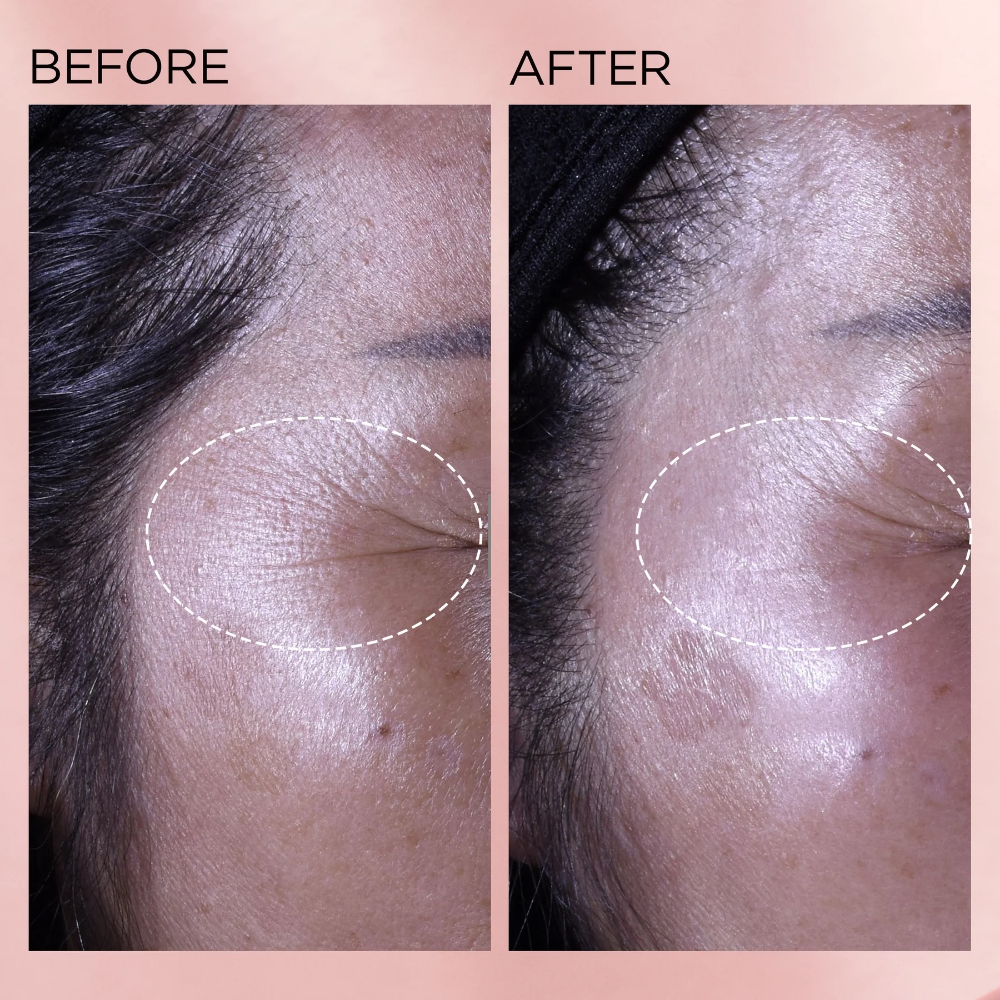 Elizabeth Arden Retinol + HPR Rapid Skin Renewing Ceramide Serum 90 Capsules