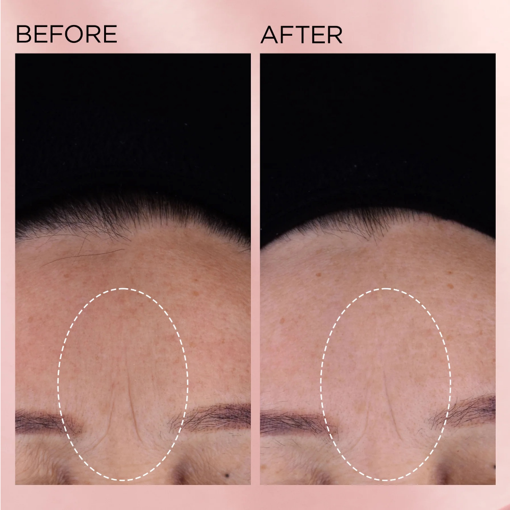 Elizabeth Arden Retinol + HPR Rapid Skin Renewing Ceramide Serum 90 Capsules