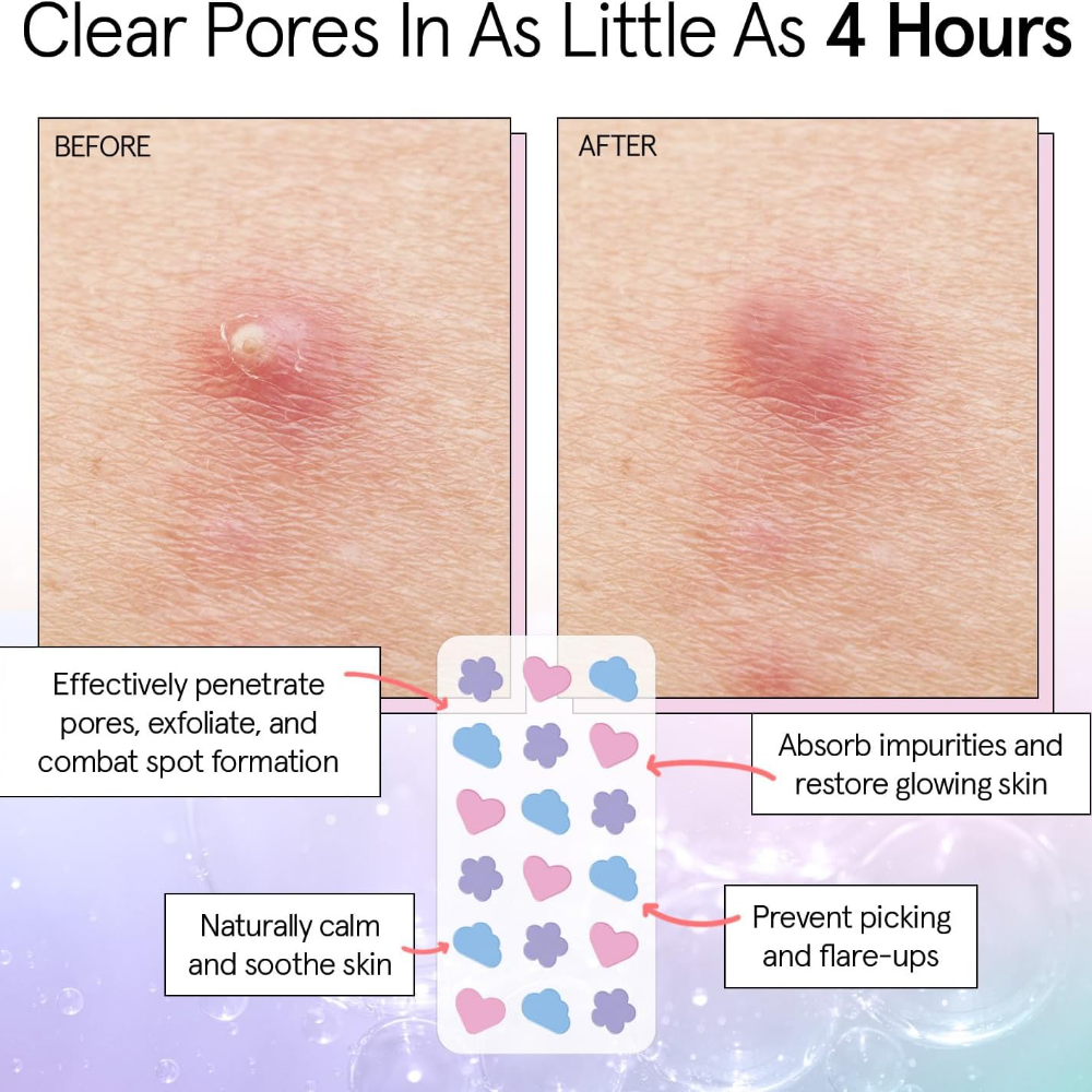 Grace & Stella Hydrocolloid Pimple Patches Multishape x36