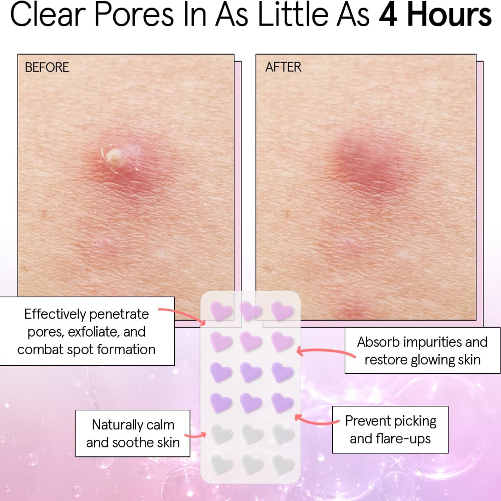 Grace & Stella Hydrocolloid Pimple Patches Heart x72