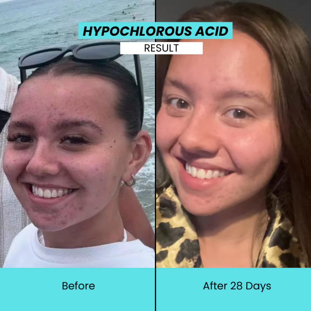 Kanzen Derma Anti-Bacterial Hypochlorous Acid Cleansing Water 500ml