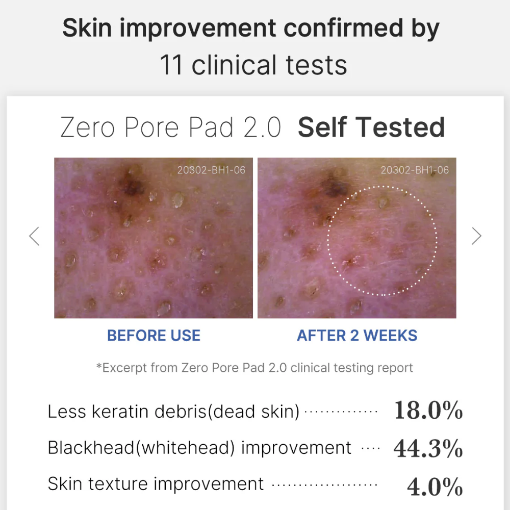 Medicube Zero Pore Pad 2.0 x70