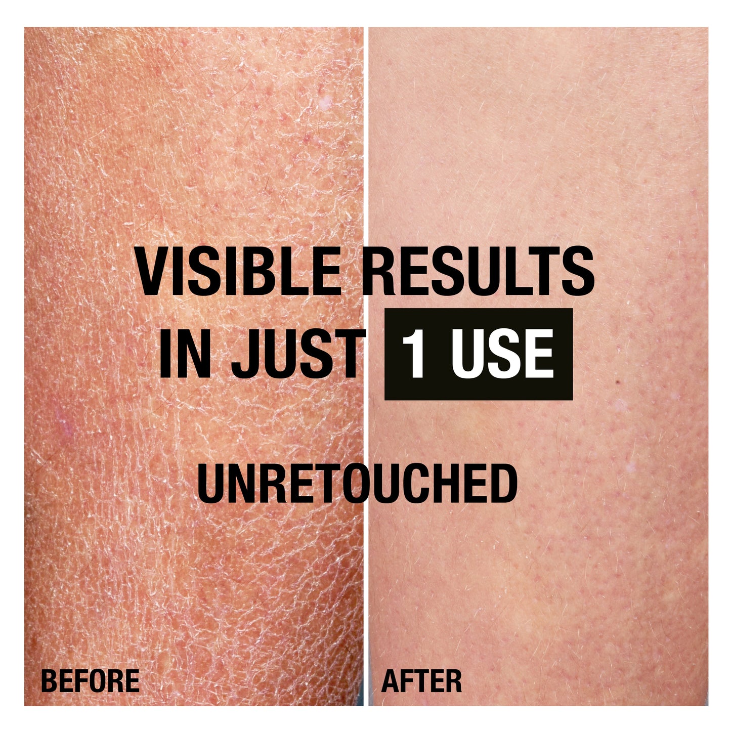 Neutrogena Norwegian Formula Deep Moisture Fast Absorbing Body Lotion 400ml