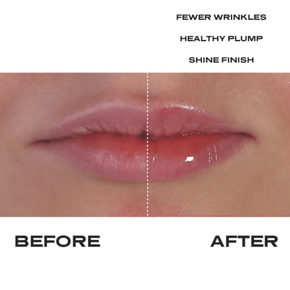Plump It No Needles Lip Kit Builders