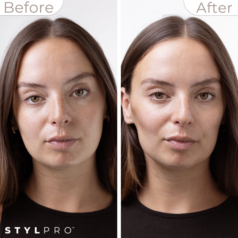 StylPro Mini Microcurrent Facial Toning Device