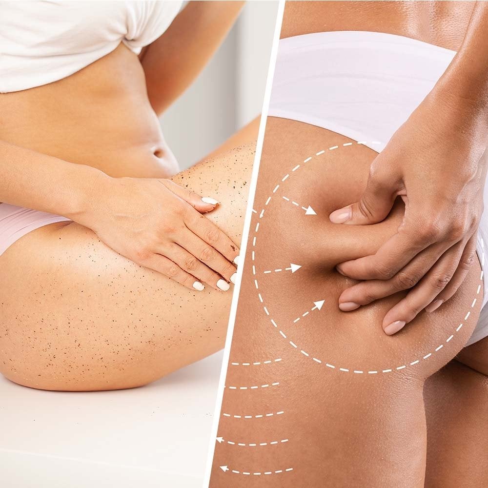Biovene Niacin Cellulite Extra-Firming Body Exfoliator 250ml