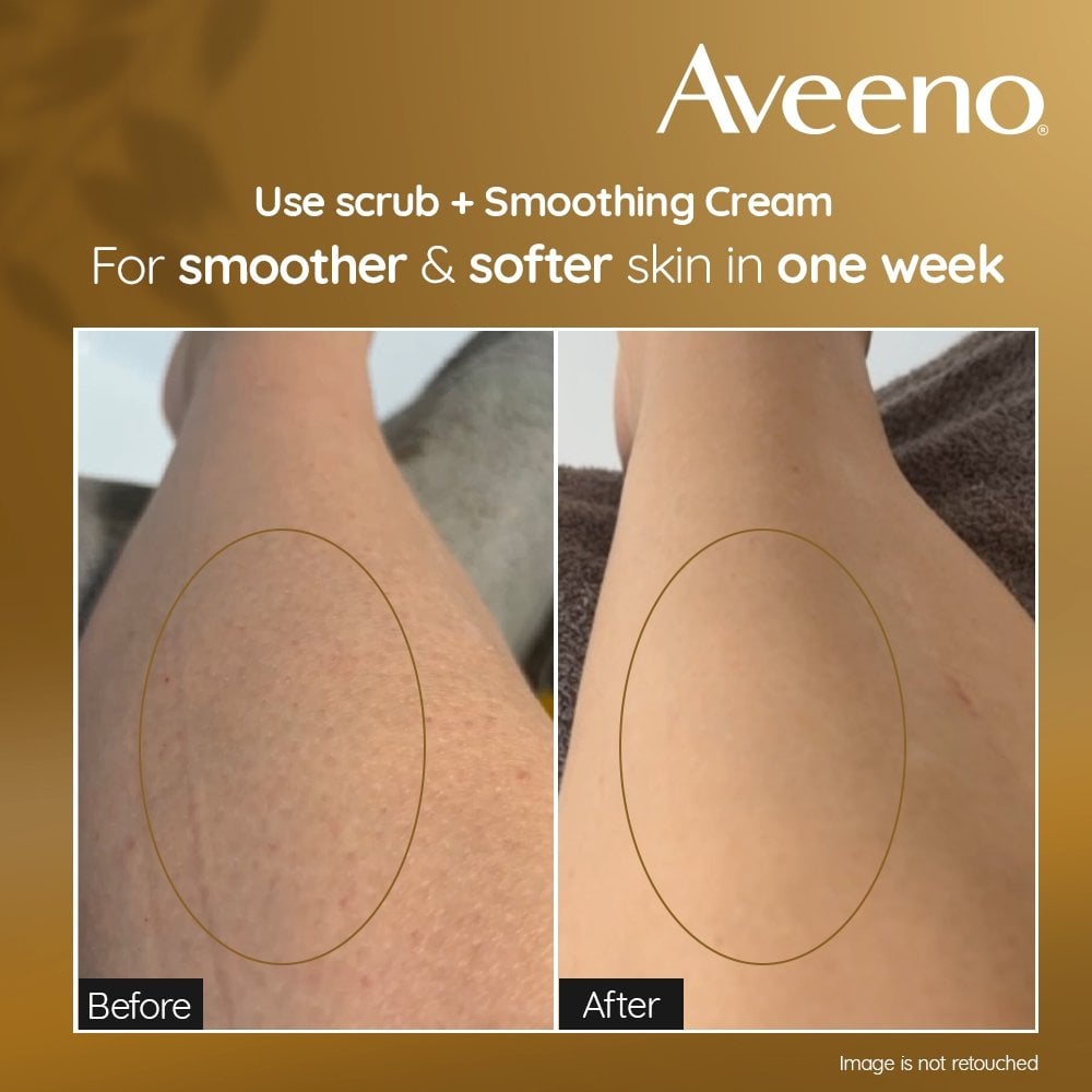 Aveeno Skin Renewal Gentle Body Scrub 200ml