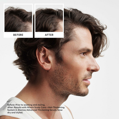Nioxin System 2 Hair Starter Kit for Natural Hair with Progressed Thinning