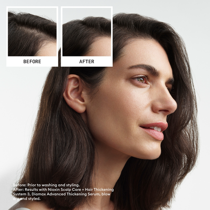 Nioxin System 3 Hair Starter Kit for Coloured Hair with Light Thinning