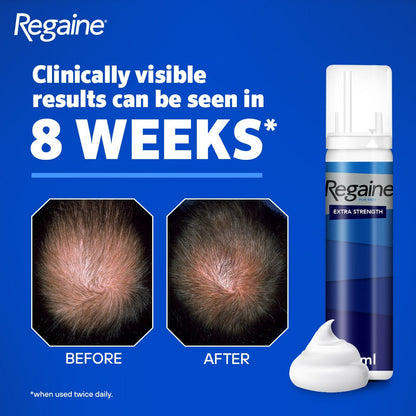Regaine For Men 5% Extra Strength Regrowth Foam 3 Month Supply
