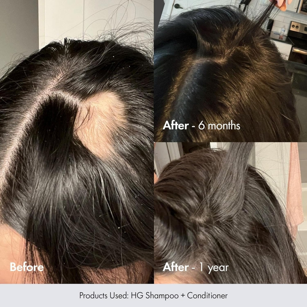 BondiBoost HG Shampoo 300ml