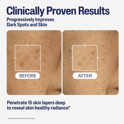 Cetaphil Healthy Radiance Brightening Serum 30ml