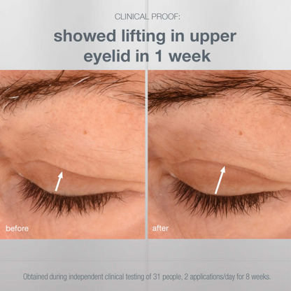 Dermalogica Phyto Nature Lifting Eye Cream 15ml