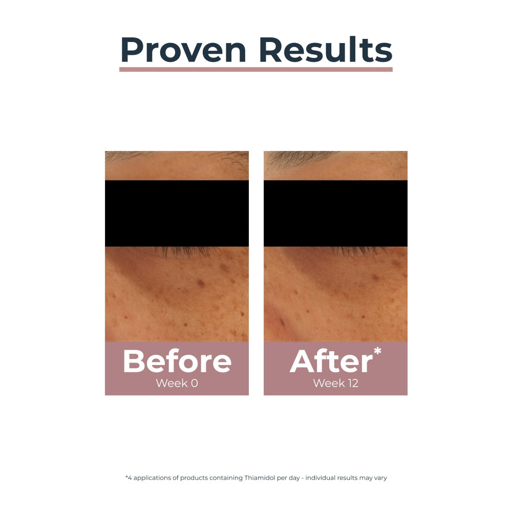 Eucerin Anti-Pigment Dark Circle Illuminating Eye Treatment 15ml