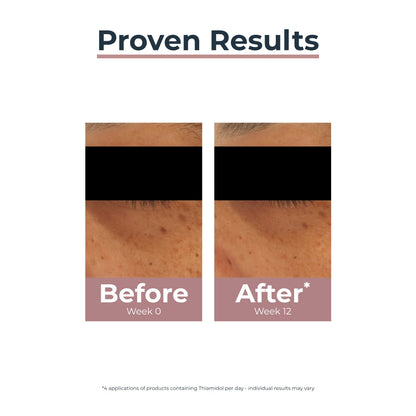 Eucerin Anti-Pigment Dark Circle Illuminating Eye Treatment 15ml