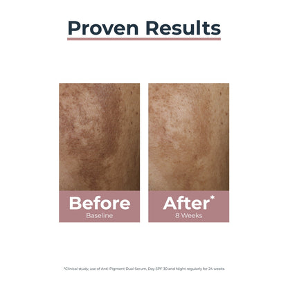 Eucerin Anti-Pigment Skin Perfecting Serum 30ml