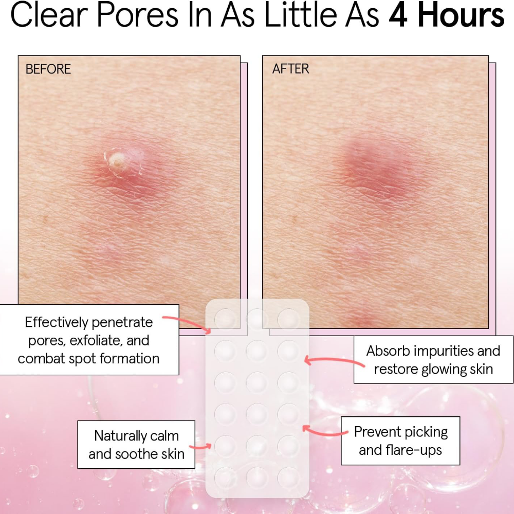 Grace & Stella Hydrocolloid Pimple Patches Clear x36