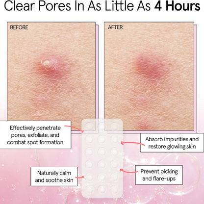 Grace & Stella Hydrocolloid Pimple Patches Clear x36