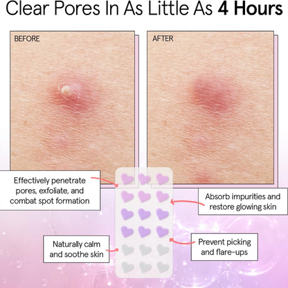 Grace & Stella Hydrocolloid Pimple Patches Heart x36