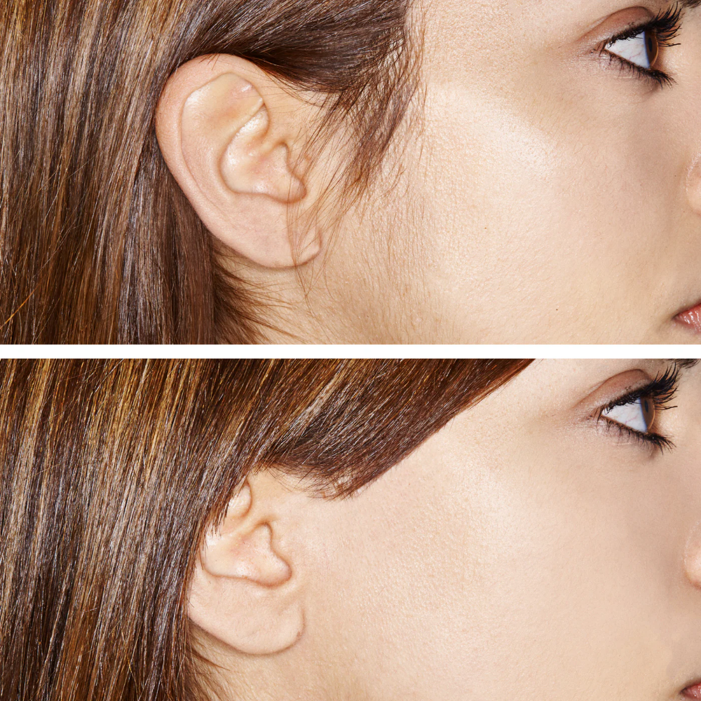 Hollywood Browzer Microplaning Hair Removal & Dermaplaning Tool Pearl