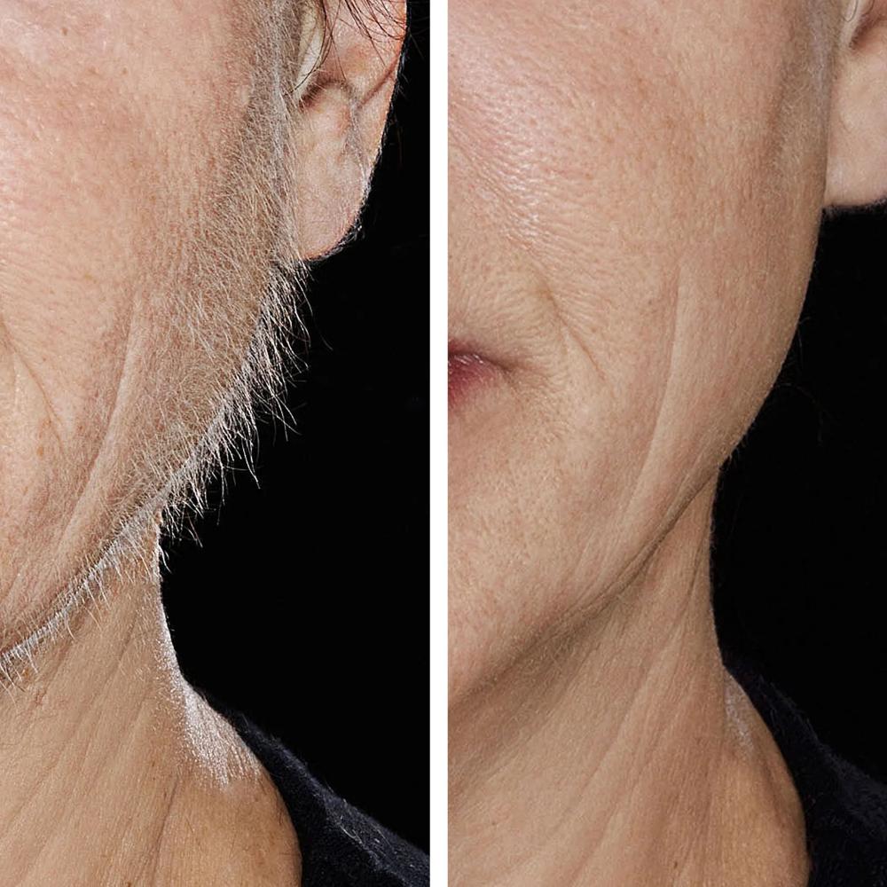 Hollywood Browzer Single Browzer Hair Removal & Dermaplaning Tool Amethyst