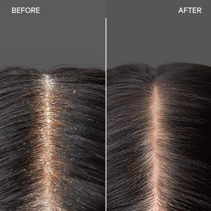 Joico Scalp Vitality Replenishing Essence 100ml