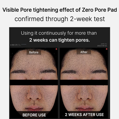 Medicube Zero Pore Pad 2.0 x70