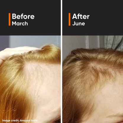 Minimalist Hair Density Hair Serum 18% 30ml