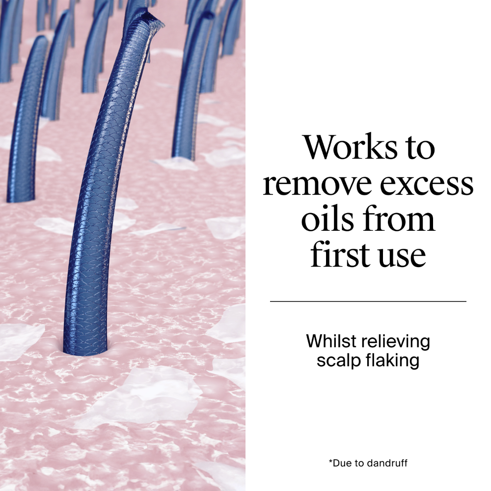 Neutrogena T/Gel Anti-Dandruff Shampoo for Oily Scalp 250ml