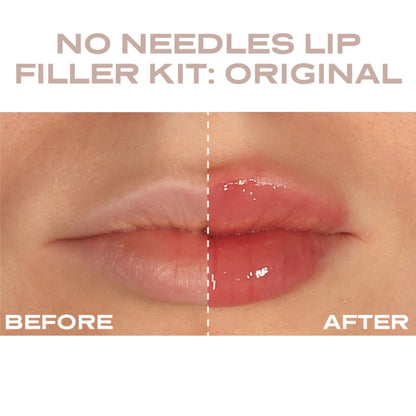 Plump It No Needles Lip Filler Kit