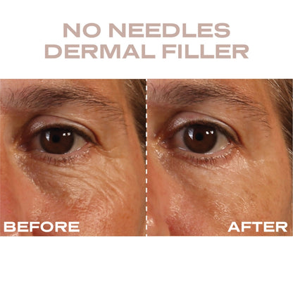 Plump It No Needles Derma Filler Pods Starter Kit 15 x 10ml