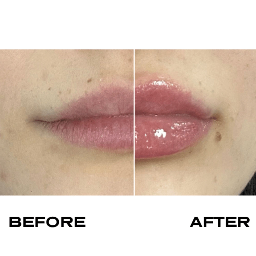 Plump It No Needles Lip Filler Kit Extreme Volume