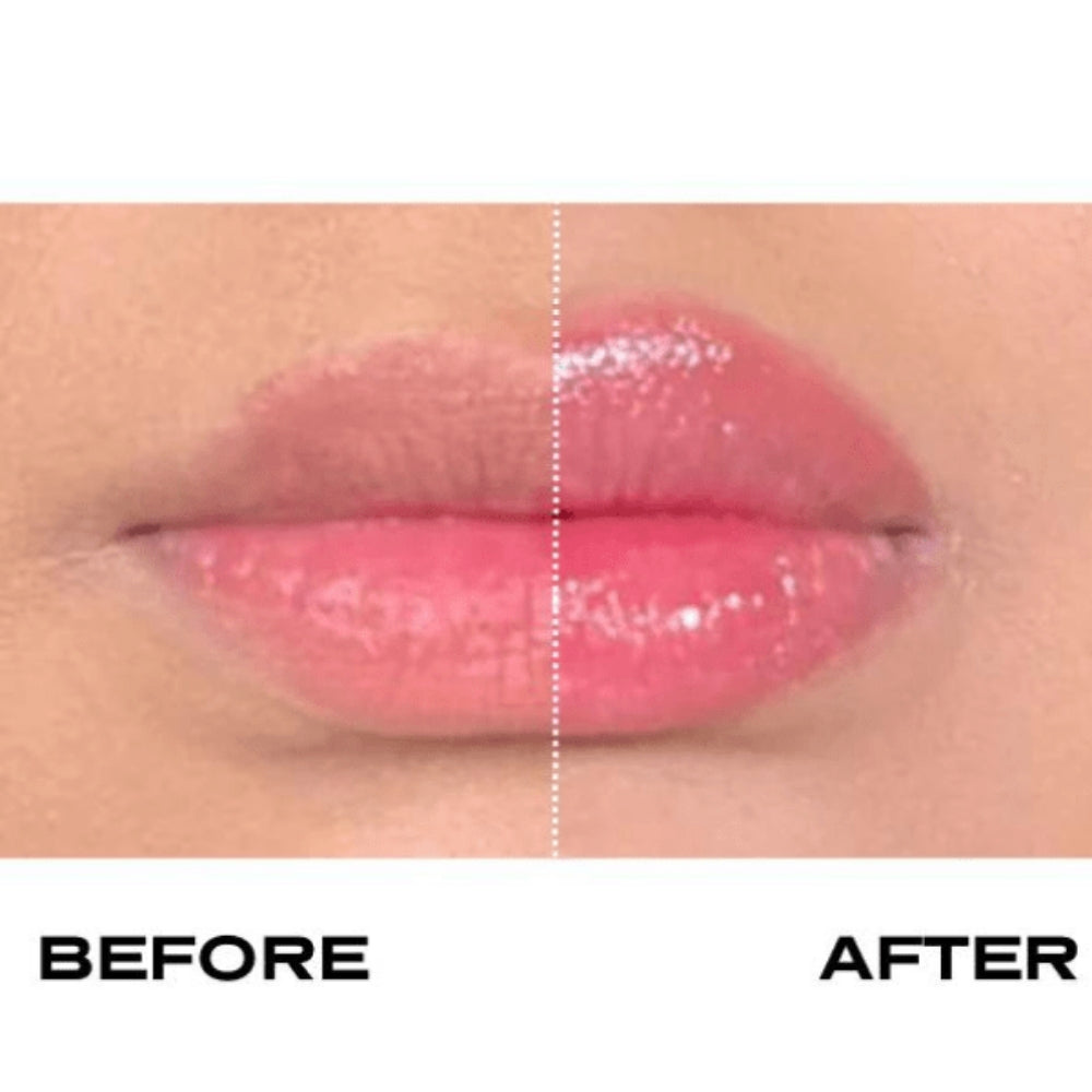 Plump It No Needles Lip Filler Kit Extreme Volume