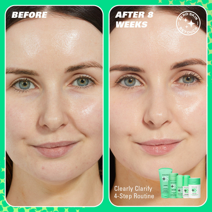 Revolution Skincare Clearly Clarify 4 Step Clarifying Routine