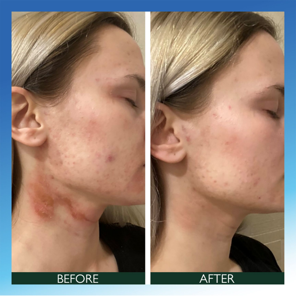 Sorted Skin Intensive Rescue Spray 100ml