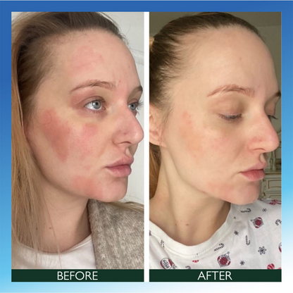 Sorted Skin Intensive Rescue Face Lotion 50ml