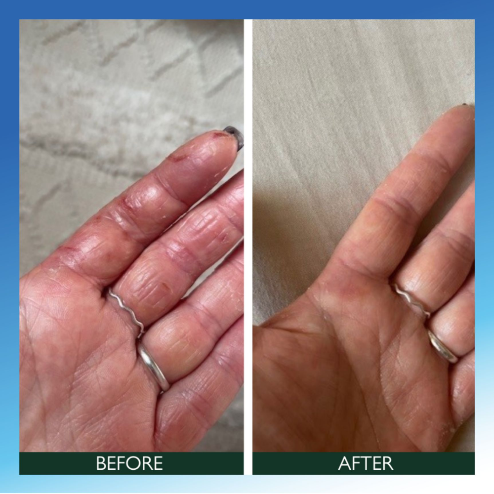 Sorted Skin Intensive Rescue Moisturiser 100ml