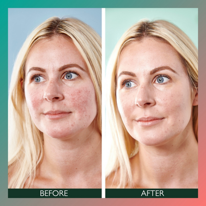 Sorted Skin 3-In-1 Anti-Redness Face Serum 30ml