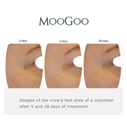 MooGoo Bakuchiol 1% Natural Retinol Substitute Active Serum 25ml