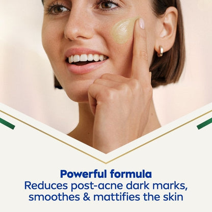 Nivea Cellular Luminous 630 Anti Dark-Spot Post-Acne Dark Marks Serum 30ml