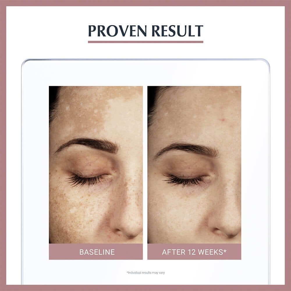 Eucerin Anti-Pigment Dual Face Serum 30ml