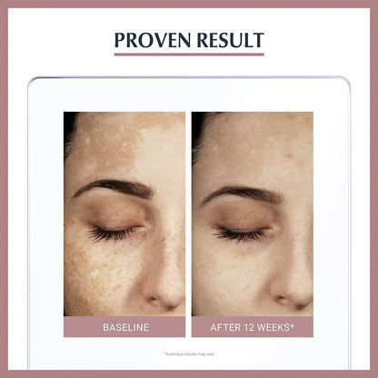 Eucerin Anti-Pigment Dual Face Serum 30ml