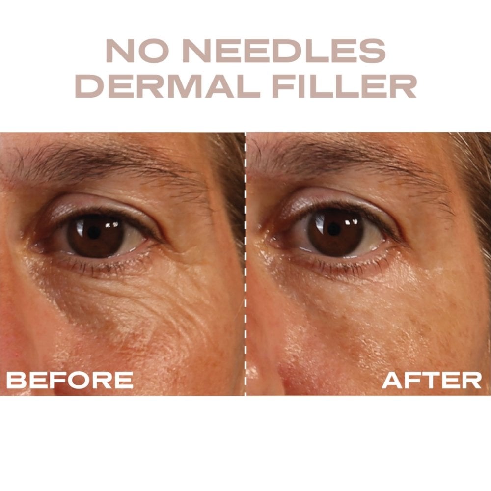 Plump It No Needles Derma Filler Pods Starter Kit 15 x 10ml