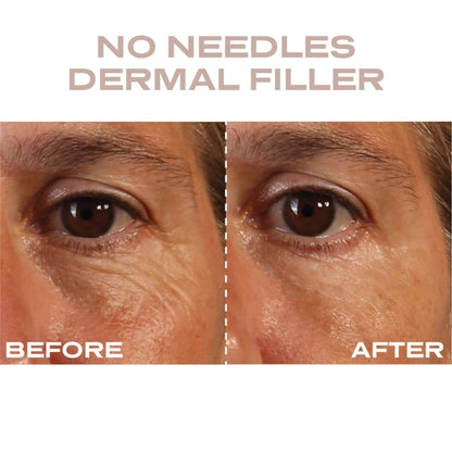 Plump It No Needles Derma Filler Pods Starter Kit 15 x 10ml