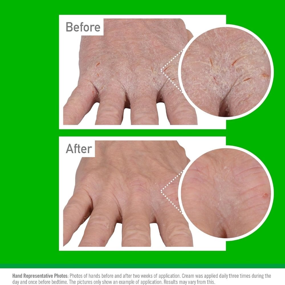 O'Keeffe's Clinical Hand Eczema Relief Hand Cream 57g