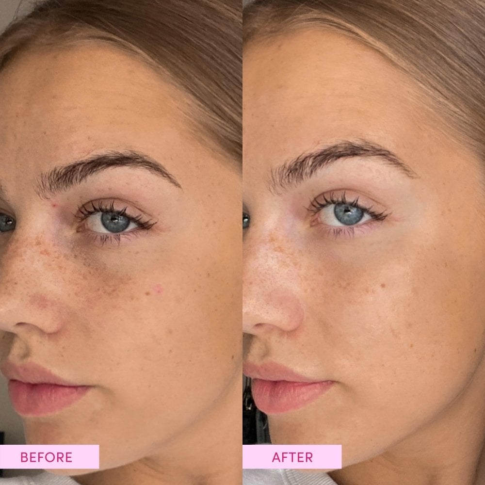 Sand & Sky Australian Emu Apple Dreamy Glow Drops 30ml